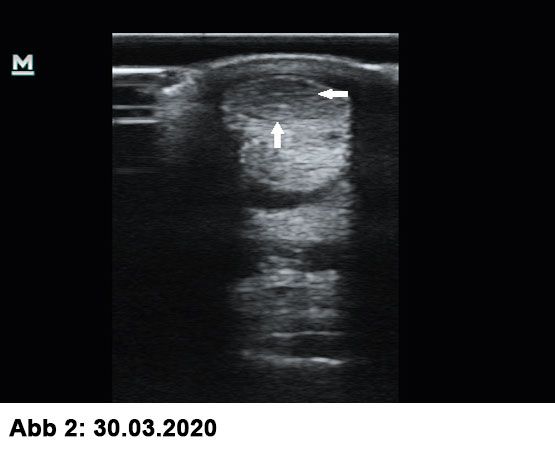 Röntgenbild Beugesehne